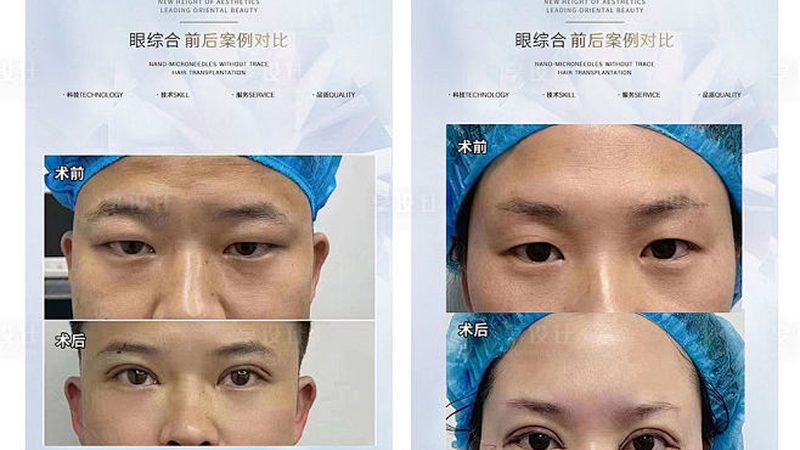 广州整形美容术前流程：揭秘优质服务的核心要素