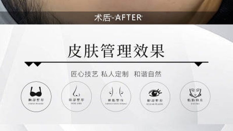 激光美容仪器ODM厂家哪家靠谱