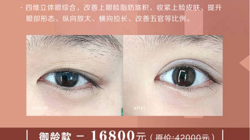 双眼皮术后热敷，材质选择有讲究
