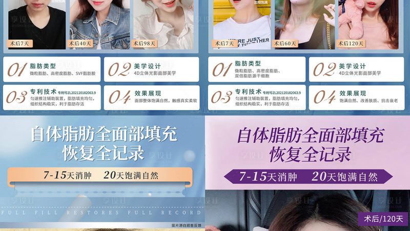 永久脱毛，真的有效吗？揭秘脱毛技术的真相**