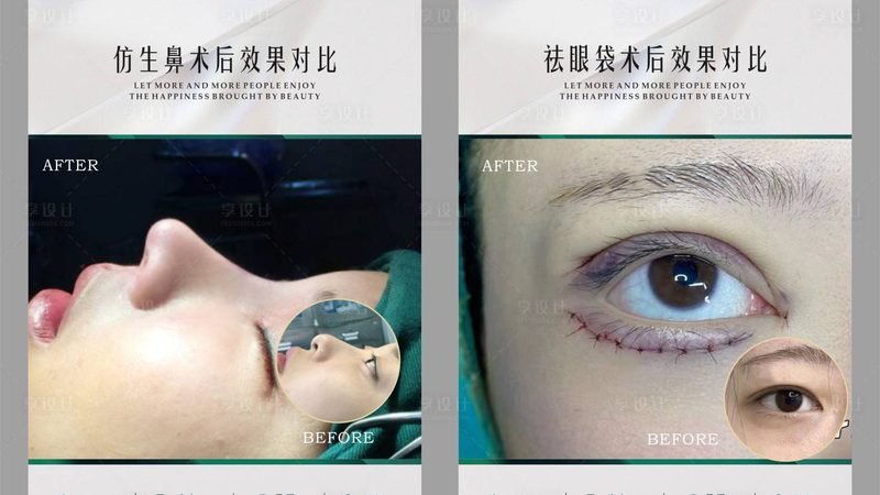 皮秒激光与调Q激光：揭秘祛斑技术的微妙差别