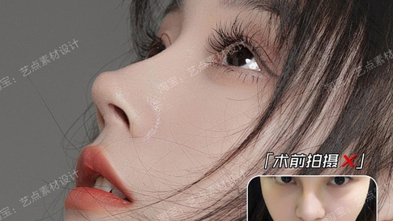 激光美容祛斑仪器型号参数大全