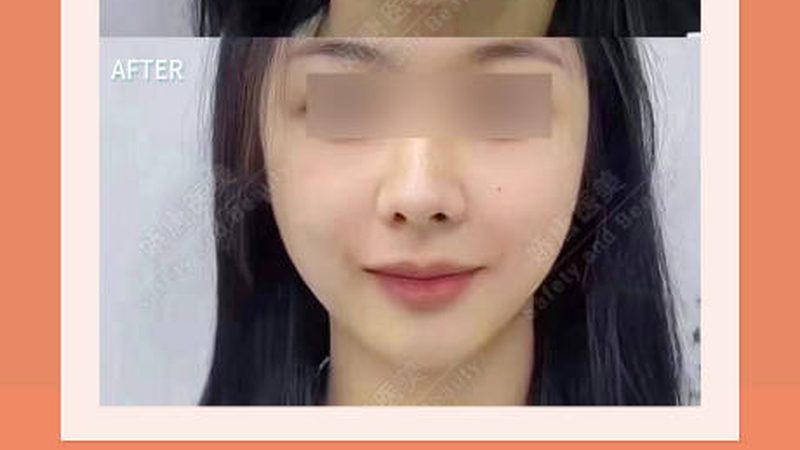 小标题：了解医美，从认识风险开始