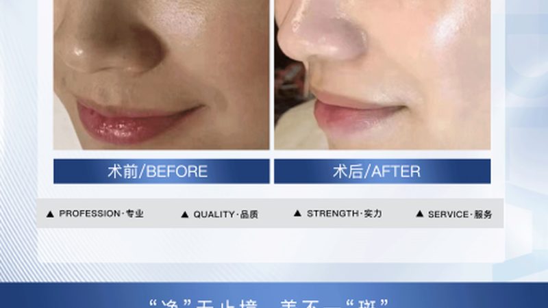 医美整形风险几何？真实案例揭秘行业真相