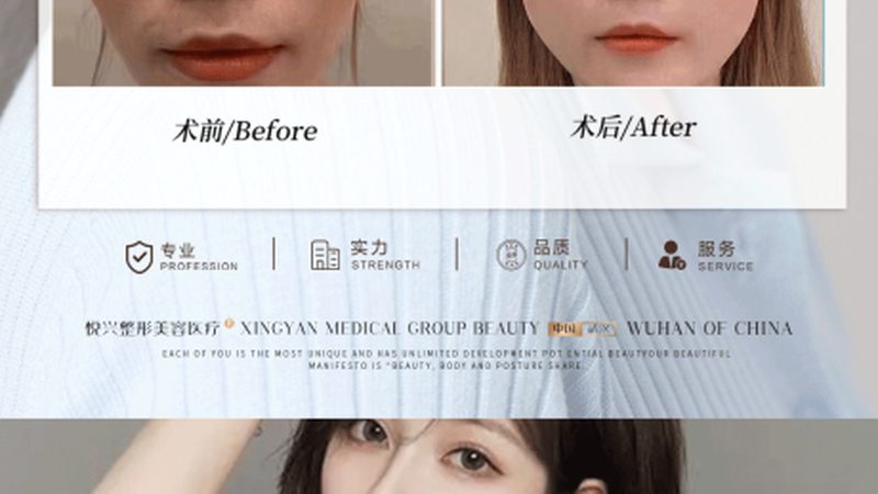 术后黄金72小时，你的护肤可能全做错了