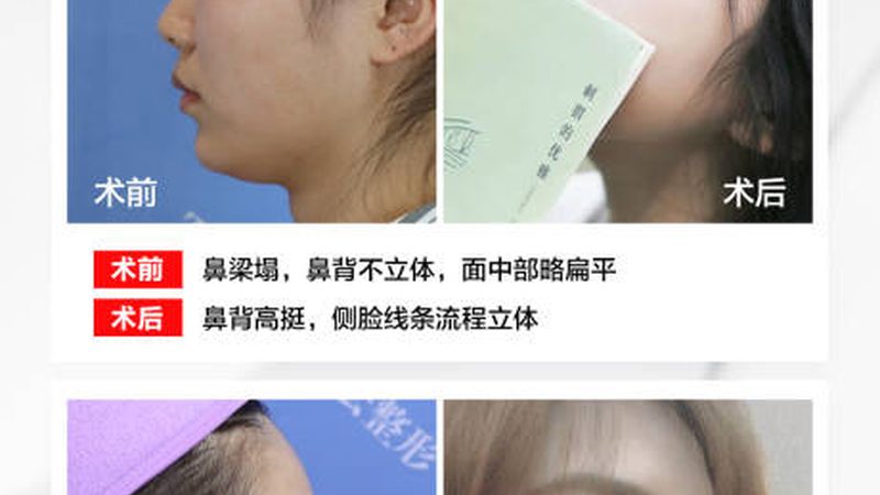 脱毛仪和美容院光电脱毛到底差在哪