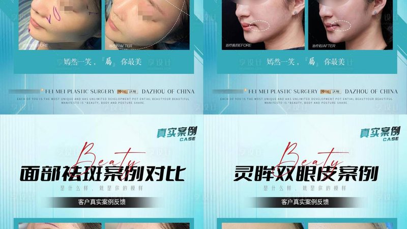 厦门公立医院双眼皮修复：揭秘专业与安全的选择