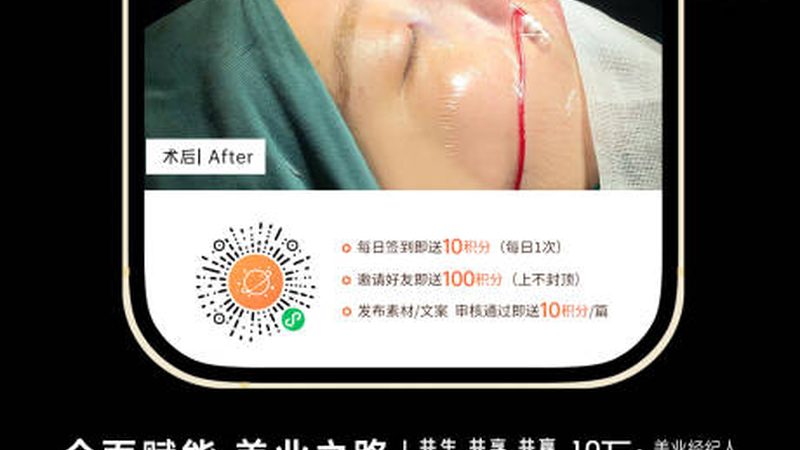 激光美容祛痘坑，揭秘效果与注意事项