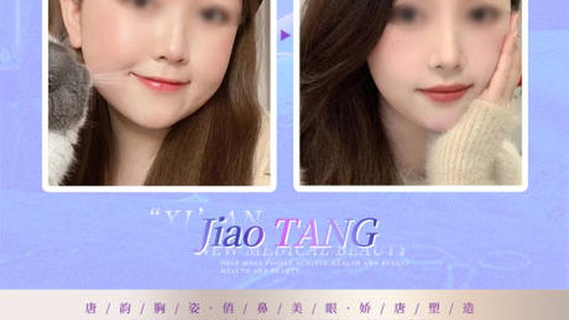 光子嫩肤家用机选购攻略：揭秘避坑技巧