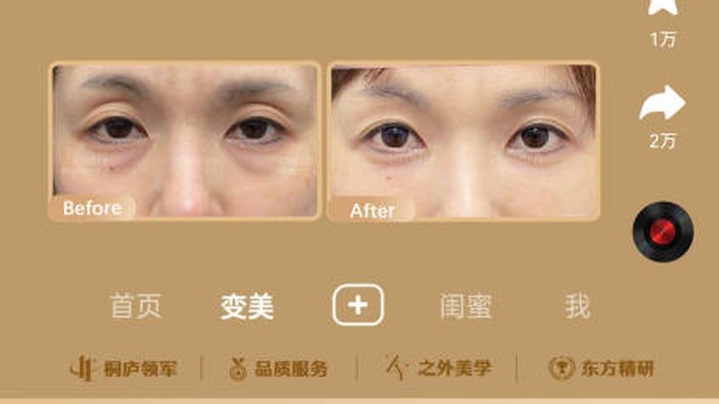 如何辨别热玛吉真伪？揭秘四大鉴别技巧