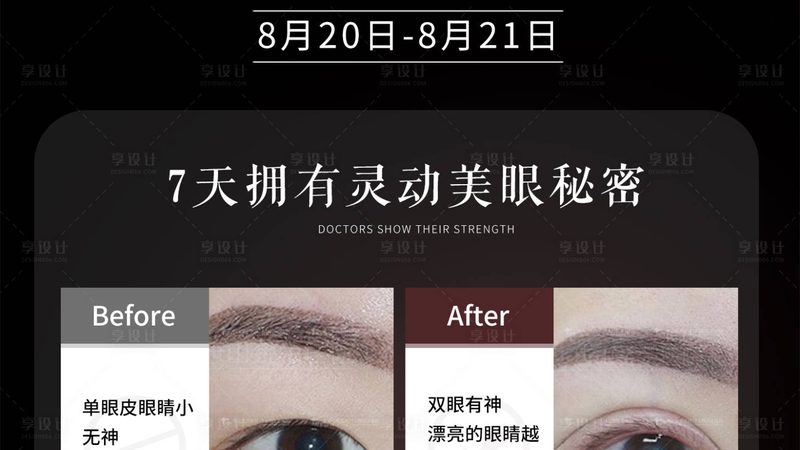 激光祛斑，设备参数揭秘：如何选择适合自己的设备？**