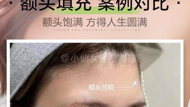 热玛吉与超声炮：揭秘两者差异与参数对比