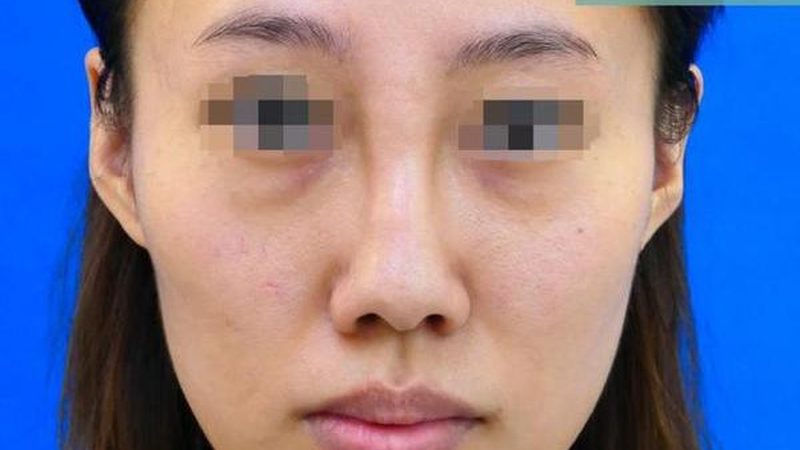 2025医美品牌排行榜：揭秘行业趋势与选择标准